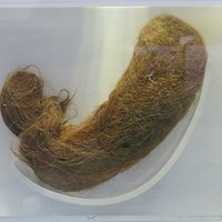 Human Hairball