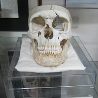 Phineas Gage's skull