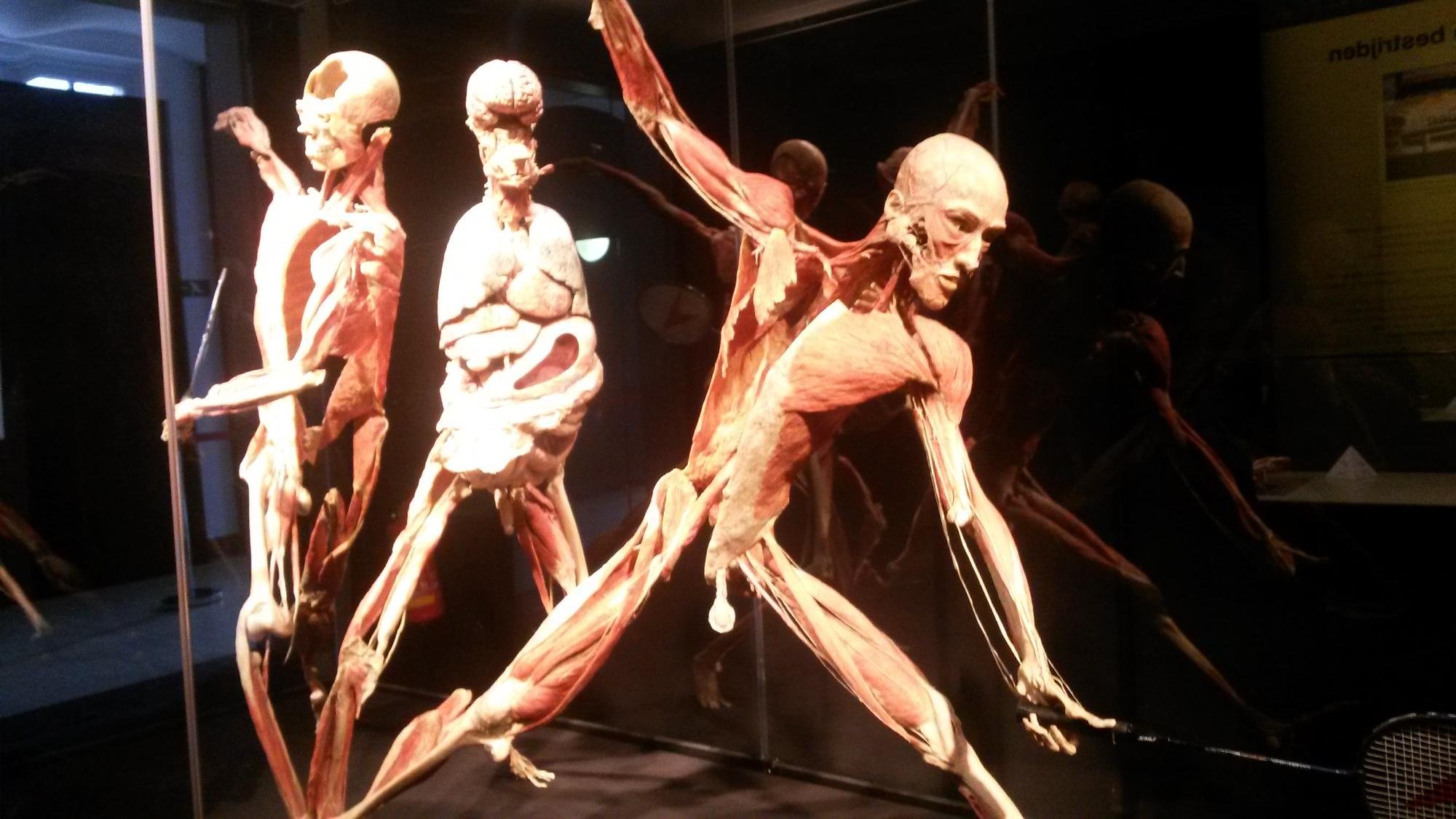 Gunther von Hagens Body Worlds All You Need to Know BEFORE You