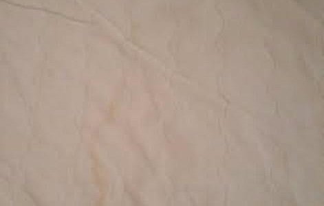 Stained Mattress Protector. Unbelievable! Disgusting.