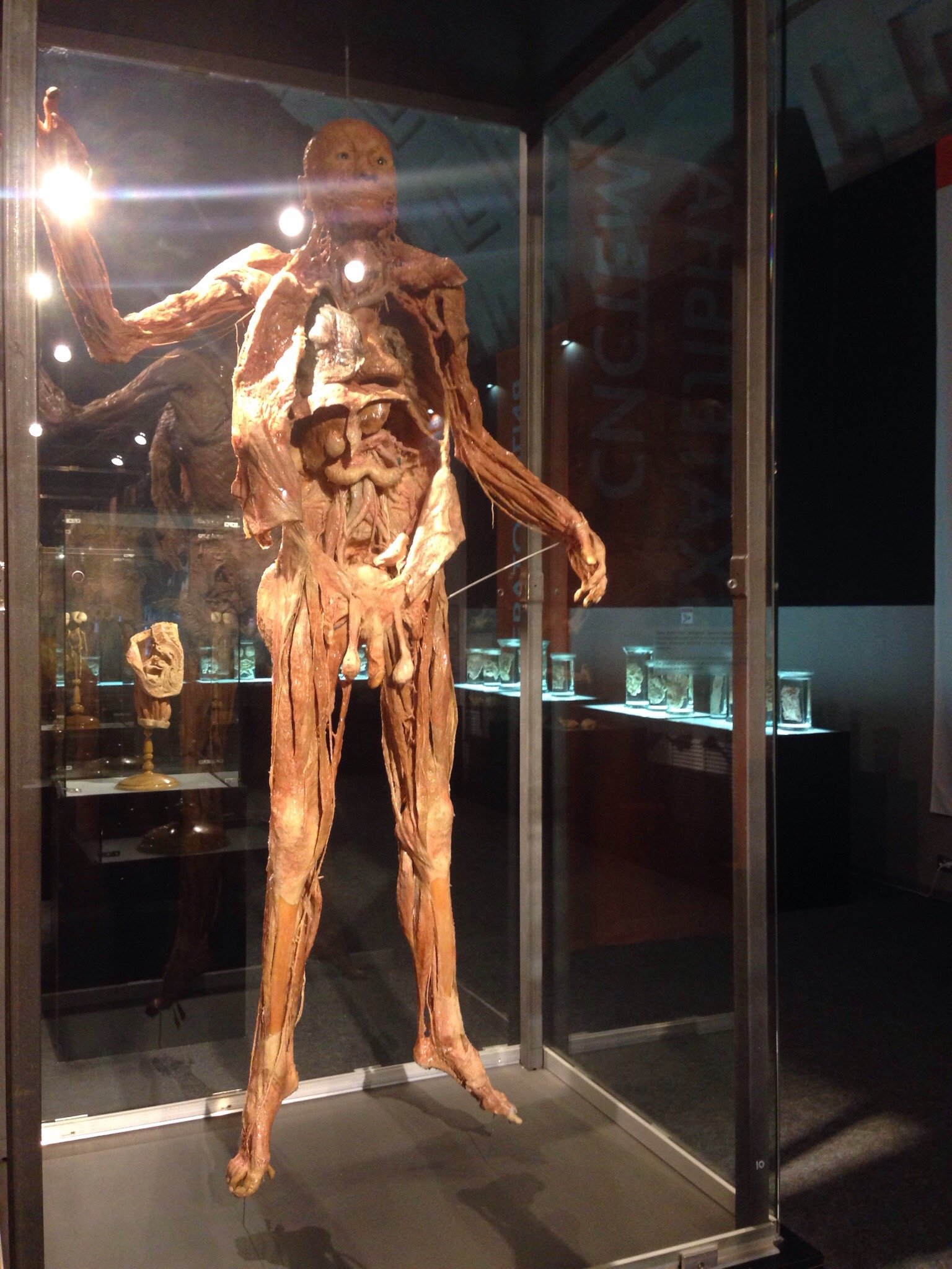 Museum Exhibition Human Body St Petersburg All You Need To Know   Photo0jpg 