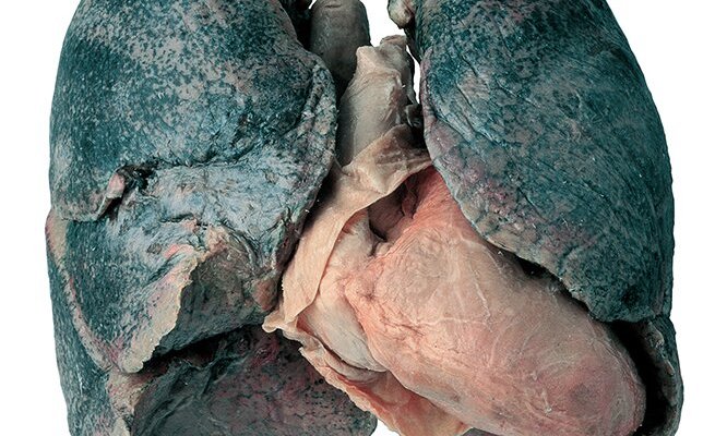 Visit expo BODY WORLDS at site Oud Sint-Jan in Bruges until 5 november 2023