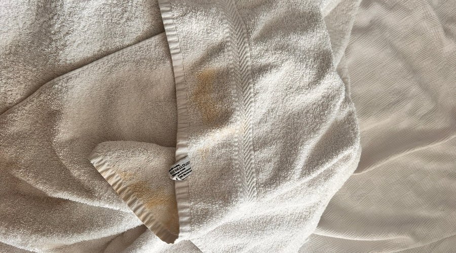 Bu otelde sadece bir gece 20-21 Temmuz akşamı kaldık. Çok bile geldi. Otel hijyen değildi. Banyo duvarındaki kıllardan mı başlıyım yoksa bu fotoğraflarda gördüğünüz gibi kahverengi leke olan havlular ve kanepeden mi. Sabah çok erken check out ettik çünkü uyuyamadık. Lobideki resepsiyonist arkadaşa söyledik ve her ne kadar fotoğrafları benden alıp yardımcı olmaya çalışmak istese de ‘Size yanlışlıkla kirli havlu getirmişlerdir’ demesi beni otelden daha da nefret ettirdi.